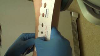 Skin Prick Allergy Testing ResultsNorthwest ENT and Allergy [upl. by Snebur29]