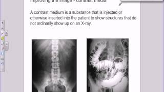 A level Medical Physics  X rays  image intensifiers and contrast media [upl. by Mab]