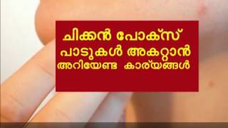 ചിക്കൻ പോക്സ് പാടുകൾ വരാതിരിക്കാനും അകറ്റാനും How to Remove Chickenpox Marks [upl. by Bond]