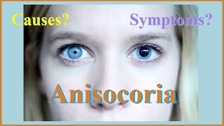 anisocoria [upl. by Corydon]