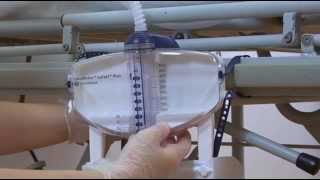 Using UnoMeter AbdoPressure™ Overview [upl. by Thirza]