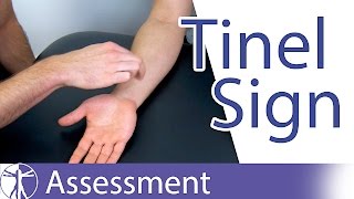 Tinel Sign Wrist  Carpal Tunnel Syndrome Diagnosis [upl. by Alfonse]