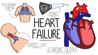 Heart Failure Explained  HFrEF vs HFpEF Systolic vs Diastolic Heart Failure [upl. by Barret899]