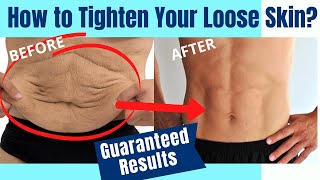 How to Tighten Loose Skin  100 Guaranteed Results looseskin getridoflooseskin removelooseskin [upl. by Joacimah]