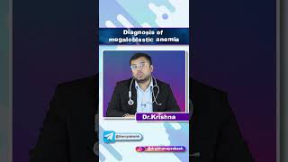 Diagnosis Of Megaloblastic Anemia  Quick Bites Internal medicine Hematology [upl. by Delila261]