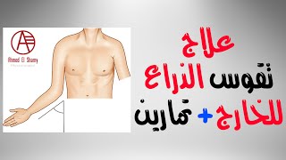 تقوس الذراع للخارج  تمارين علاج تقوس الكوع للخارج  Cubitus valgus [upl. by Garrik]