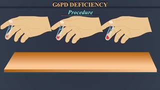 G6PD Deficiency [upl. by Arvy]