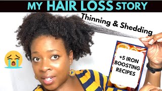 My Hair Loss Story  Iron deficiency Anemia amp 5 Iron BOOSTING recipes Low Iron [upl. by Bostow]