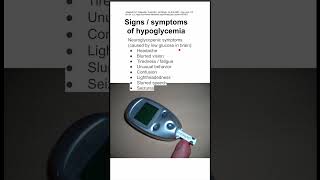 Signs  symptoms of hypoglycemia [upl. by Steep]