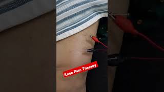 Dry Needle Therapy for knee painReduce knee PainNeedle TherapyRelief knee Pain TreatmentDrAnup [upl. by Ainollopa]