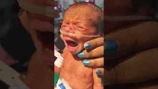 Newborn IUGR baby cry 😭🙏❣️shortvideotrending viral youtubeshortsshortsbaby divyaverma2401 [upl. by Unders665]