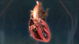 Impella® Heart Pump Animation For Patients [upl. by Leraj208]