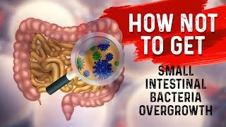 How to STOP Small Intestine Bacterial OvergrowthSIBO – Dr Berg [upl. by Aneahs]