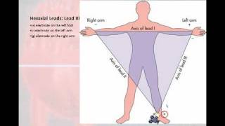 12 Lead Interpretation Part 1 Introduction to the 12 Lead EKG [upl. by Ajay608]