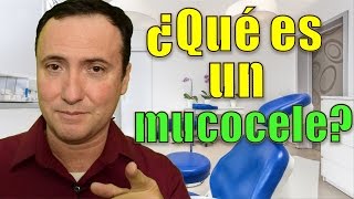 ¿Qué es un mucocele [upl. by Ellenehc]