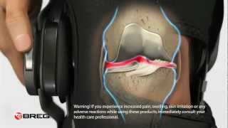 Learn About Knee Osteoarthritis OA [upl. by Ahsemal]