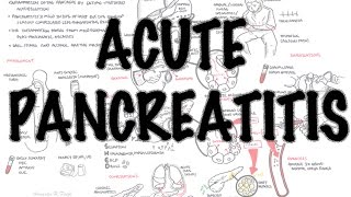 Acute Pancreatitis  Overview signs and symptoms pathophysiology investigations treatment [upl. by Martinez]