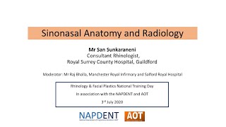 Rhinology  Sinonasal Anatomy and Radiology  Mr San Sunkaraneni [upl. by Zicarelli]