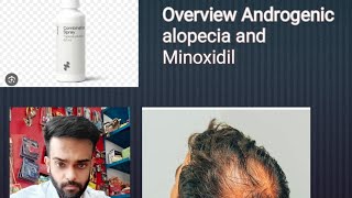 Overview Androgenic alopecia and minoxidil Yeashchowdury viralvideo [upl. by Streeter]