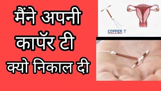 कापॅर टी क्या होती है  Copper T uses and side effects in hindi [upl. by Pablo]