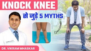 Exercise आपके knock knees को ठीक कर सकती है  Knock Knee से जुड़े 5 Myths  Dr Vikram Mhaskar [upl. by Aisorbma621]