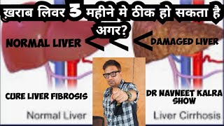 How to Cure your damaged liver  क्या ख़राब लिवर ठीक हो सकता है जी हा पर कैसे [upl. by Aikemaj]