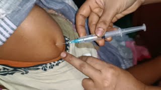 IM Intramuscular Arm injection Push Hydrocortisone  Cotson  injection 24 Ep 99 Anik Health Tips [upl. by Aidan]