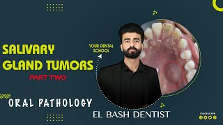 malignant salivary gland tumors  oral pathology  فيديو نهاية المنهج [upl. by Loredo797]