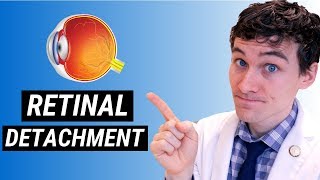 Retinal Detachment Symptoms and Treatment  How Retinal Detachment is Treated [upl. by Ardeid]