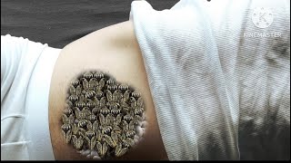 ASMR belly infection cleaning and treatment 2d animation video [upl. by Vivienne]