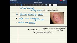 35🌟 Dermatophytosis Microbiology Medical Dose [upl. by Colvert]