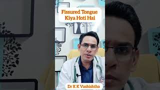 Fissured Tongue kiya hoti hai healthcare medical knowledge healthtips doctor diabetes [upl. by Grous]