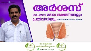 Piles Malayalam  പൈൽസ് മാറാൻ  Moolakkuru Home Remedy  അര്‍ശസ് മാറാൻ  Dhanwantharan Vaidyar [upl. by Canale]