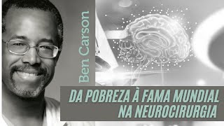 Ben Carson  O neurocirurgião que fez o Impossível [upl. by Llenyr]