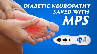 Diabetic Neuropathy Patient Avoids Amputation with the Use of MPS Scar Release Therapy [upl. by Arabella550]