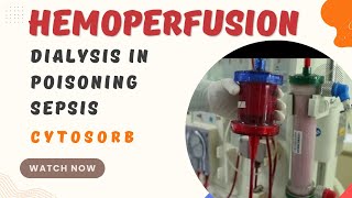 What is Hemoperfusion  Dialysis in Poisoning  Dialysis in sepsis  cytosorb [upl. by Irod]