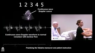 How to Perform Valsalva Maneuver in Patients with HCM [upl. by Skill824]