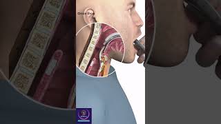 Endotracheal Intubation education shorts [upl. by Akcirederf]