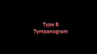 type B tympanogram [upl. by Cam124]