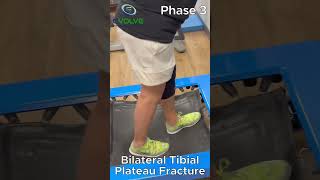 Bilateral Tibial Plateau Fractures How to Build Strength and Stability With Jumping [upl. by Affer288]