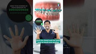 கிளிப்பை கழட்டும் முன் இதை பாருங்கள் How to Check Braces Completion DrKarthikeyan Denta Kings [upl. by Leahcim977]