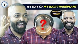 1st Day of Hair Transplant Surgery  Hairline Redesign  Best Result amp Cost of Hair Transplant Pune [upl. by Nadabus]