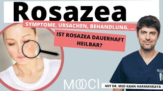 Was hilft bei Rosazea [upl. by Ybrad602]