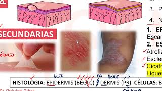 LESIONES PRIMARIAS Y SECUNDARIASDERMATOLOGÍA [upl. by Tesil]