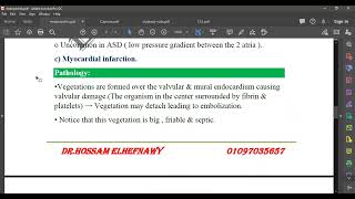 L25 Endocarditis [upl. by Hale62]