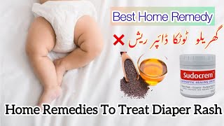 Diaper changing routine  diaper rashes treatment at home  Home remedies for diaper rash baby [upl. by Spence]