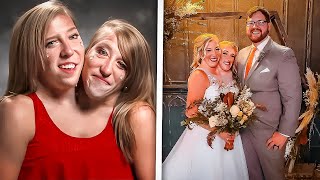 Conjoined Twins Abby and Brittany Hensel Got Married [upl. by Pollack]