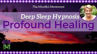 Use Your Powerful Mind Healing Deep Sleep Hypnosis  Mindful Movement [upl. by Landmeier632]