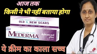 Mederma cream  Mederma for acne scars  Mederma advanced scar gel review [upl. by Blackwell856]