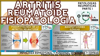 ARTRITIS REUMATOIDE FISIOPATOLOGÍA  GuiaMed [upl. by Atsahs764]